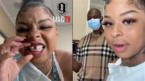 Chrisean Rock Gets Her Tooth Fixed & Says She Wants A Gap